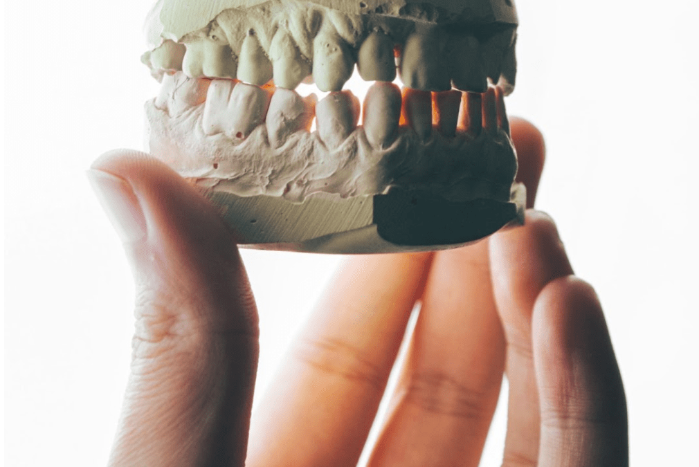 Parodontite e Sovrappeso: quale Correlazione?