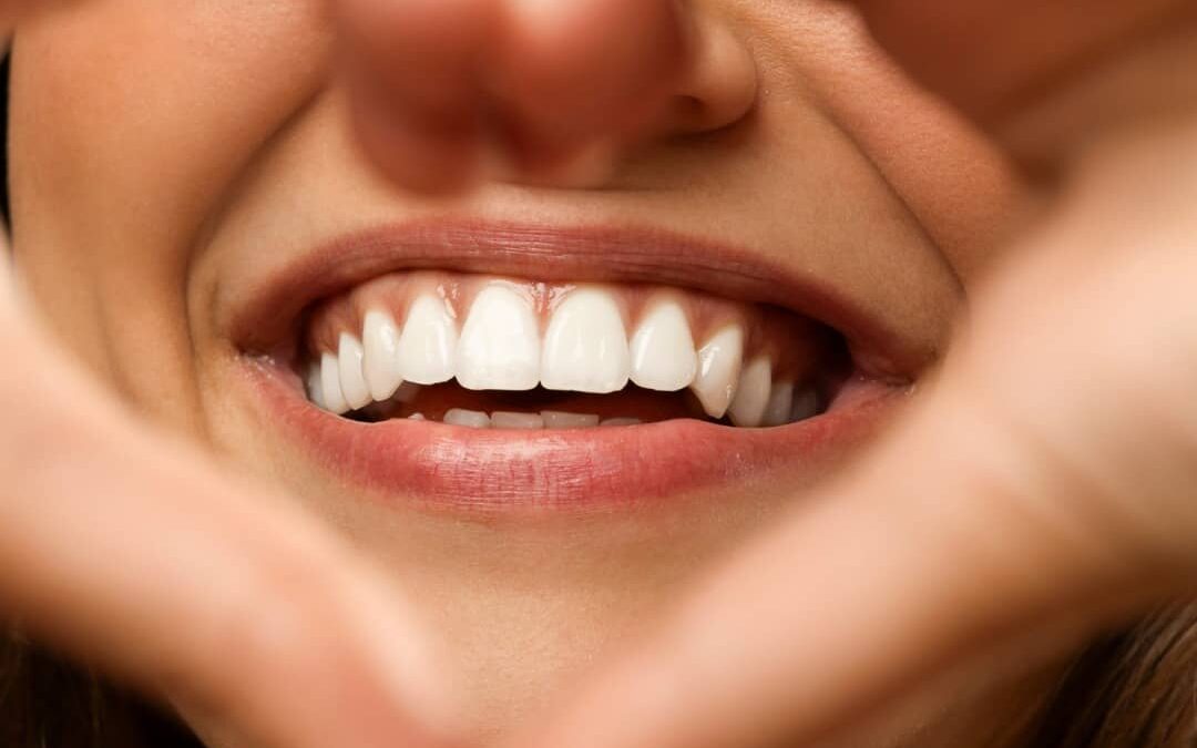 Fluoro e salute dentale: Come bilanciare i benefici e i rischi