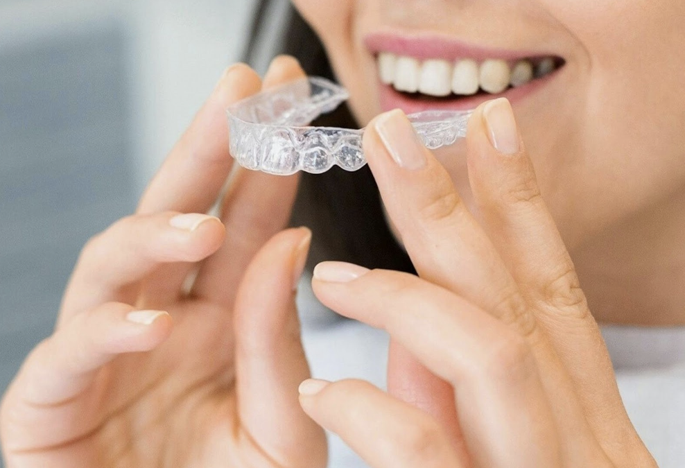 Allineatori trasparenti: Rivoluziona il tuo sorriso con discrezione!